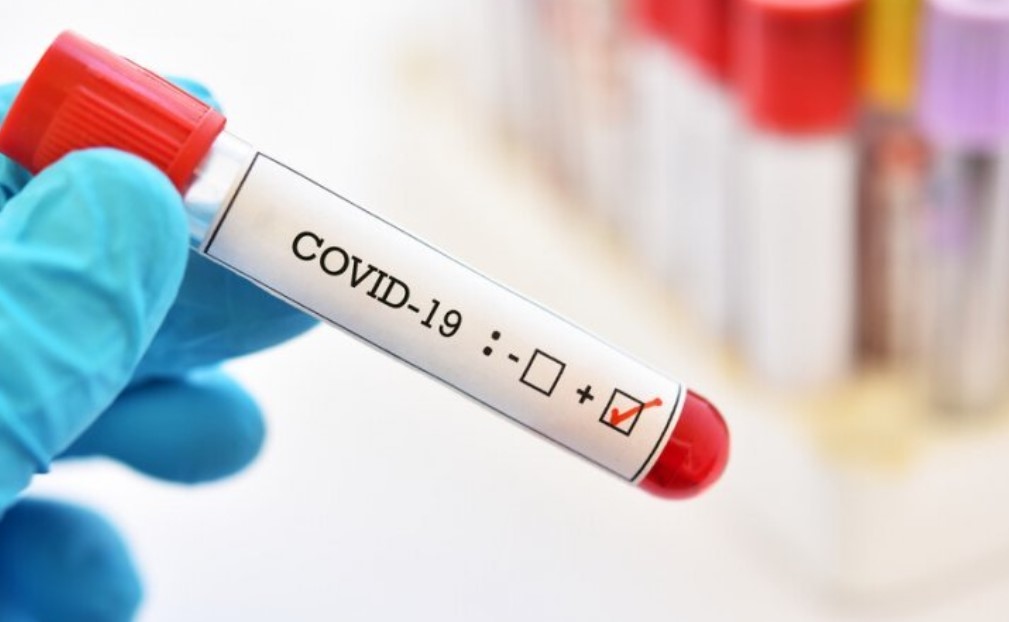 Новите случаи на коронавирус у нас за последното денонощие са